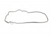 Комплект прокладок (повний) MB Actros 96- REINZ 01-34190-06 (фото 9)